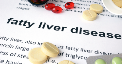 Fatty liver disease